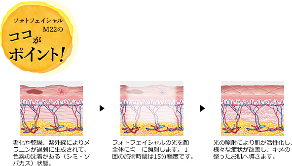 フォトフェイシャルM22のココがポイント！